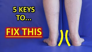 The 5 KEYS To Improve Flat Feet Fallen Arches amp Foot Overpronation [upl. by Murrell]