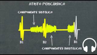 Ausculta cardíaca  cliques estalidos e atrito pericárdico [upl. by Yellehs258]