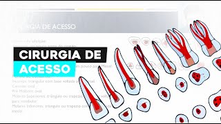 Cirurgia de Acesso Endodôntico Guia Completo para Dentistas Iniciantes [upl. by Sivraj107]