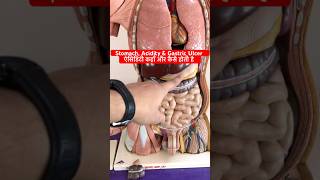 Acidity Gastric Ulcer Peptic Ulcer amp Stomach ऐसिडिटी एवं पेट के छाले कहाँ और कैसे बनते है shorts [upl. by Trisha]