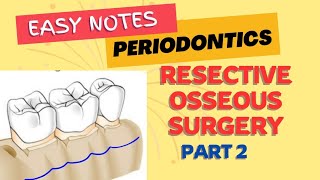 RESECTIVE OSSEOUS SURGERY  PERIODONTICS  Part 2  easy notes [upl. by Ymmak331]