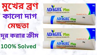 Adagel Plus Gel এর কাজ কি এর উপকারিতাব্যবহার। এর Side EffectsPrice। মুখের ব্রন দূর করার সেরা জেল। [upl. by Ahseeyt477]