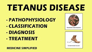 Tetanus  Tetanus Pathophysiology  Tetanus Classification  Tetanus Treatment medicine [upl. by Lerej]