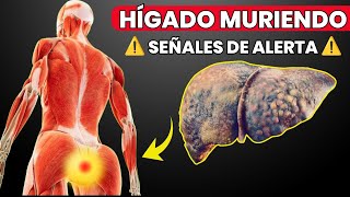 13 Signos Extraños de DAÑO en el HÍGADO [upl. by Katuscha]