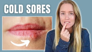 1 Tip to Stop a Cold Sore Fast and Naturally Without a Prescription [upl. by Orlena]