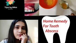 TREAT GUM ABSCESS AT HOME SELF TESTED [upl. by Mastic]