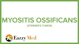 MYOSITIS OSSIFICANS STERNERS TUMOR [upl. by Nyrahs]