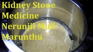 Kidney Stone Treatment Tamil  சிறுநீரக கல் கரைக்க எளிய வழிமுறைகள்  Dr Yoga Vidya Vidya Advice [upl. by Arretak38]