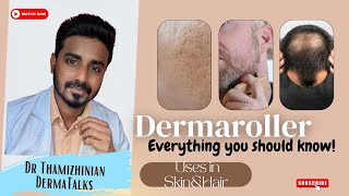 Dermaroller treatment  Dermaroller for hair growth  Dermaroller for acne scars dermaroller [upl. by Whall]