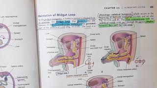 Mid gut Development and Rotation  Alimentary System Part 7 [upl. by Olegna304]