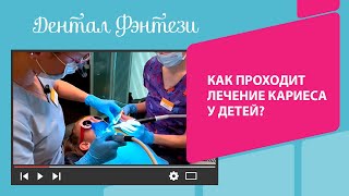 👉Как проходит лечение кариеса в Дентал Фэнтези [upl. by Valentina]