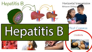 Hepatitis B symptoms treatment and prevention [upl. by Meluhs446]