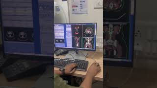 3D reconstruction ct Urography ctscan ctscantechnician trendingshorts tyshorts shortvideo [upl. by Innob341]