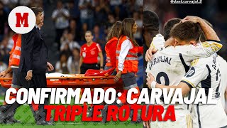 Carvajal confirma que tiene una lesión en el ligamento cruzado I MARCA [upl. by Henden416]