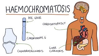 Understanding Haemochromatosis [upl. by Daven]