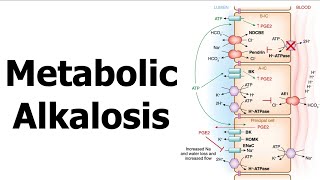 Metabolic Alkalosis [upl. by Sanyu978]