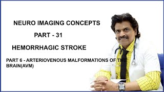 NEUROIMAGING CONCEPTS PART31PART 6HEMORRHAGIC STROKE ARTERIOVENOUS MALFORMATION OFTHE BRAINAVM [upl. by Llimaj]