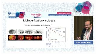 La scintigraphie osseuse dans l’amylose à transthyrétine  intérêt et limites [upl. by Ayanat438]