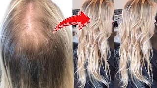 5 LIFE CHANGING HACKS FOR THIN amp FINE HAIR must watch [upl. by Mirna]