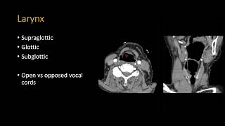 Neck CT search pattern [upl. by Doerrer432]