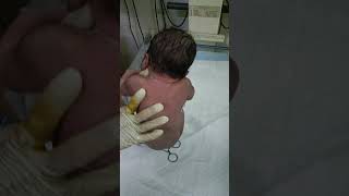 Newborn baby after birth crying motivation shorts vedio virals nursing work gnm [upl. by Ille972]