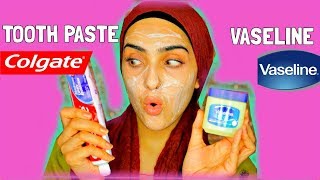 I APPLIED TOOTHPASTE AND VASELINE ON MY FACE  Look What Happened   Immy [upl. by Adner]