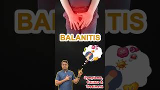 BALANITIS  पुरुष गुप्तांगो पर सूजन खुजली दर्द रेडनेस का Treatment  Dr Venkatesh Kumar noida [upl. by Odareg609]