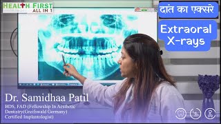 Dental XRay Types  दांतों के एक्सरे Part 3 Extraoral Xrays  Dental Clinic HeathFirst All in 1 [upl. by Waring]