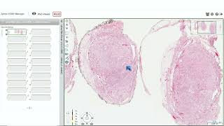 Digital Slide Pathology Review A Case Based Approach to Common Problems in Surgical Pathology [upl. by Cornell816]