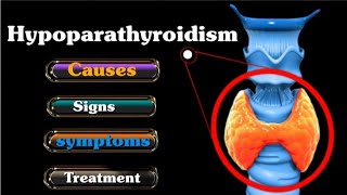 Hypoparathyroidism  Causes  Symptoms  Diagnosis  Treatment ll in Hindi endocrinesystem [upl. by Anaeli]