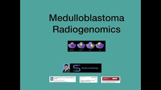 Medulloblastoma Radiogenomics Simplified [upl. by Stephen192]