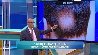 Saç kıran nasıl tedavi edilir Balçiçek ile Dr Cankurtaran 50 Bölüm [upl. by Laraine39]