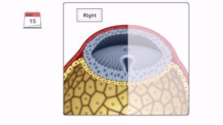 General Embryology  Detailed Animation On Gastrulation [upl. by Miarfe348]