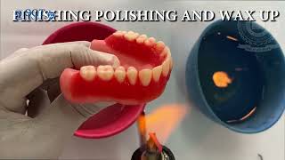 Posterior teeth arrangement  E Learning  SGT University [upl. by Aicil]