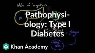 Pathophysiology  Type I diabetes  Endocrine system diseases  NCLEXRN  Khan Academy [upl. by Nnyw967]