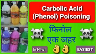 Carbolic Acid Phenol Poisoning [upl. by Rehtnug335]