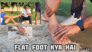 What is Flat FootFlat Foot Kya HaiMedical Test Flat Foot 2023 101 Problem Solve Defence Medical [upl. by Fabrice757]