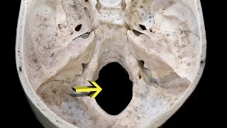 MNEMONIC  Foramen Magnum [upl. by Keele]