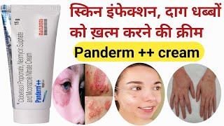 Panderm cream  Panderm cream Panderm cream use in Hindi  pendram cream ke fayde  shorts [upl. by Anelam]