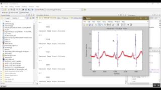 Matlab ile Sinyal Analizi  EKG Verileri Aracılığıyla Kalp Atış Hızı [upl. by Cherianne]