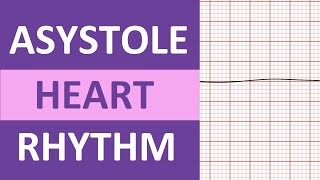 Asystole Heart Rhythm ECG Causes Treatment Nursing NCLEX Review EKG Flatline [upl. by Spiegelman]