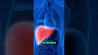 The Importance of Regular Liver Function Tests [upl. by Kerwin685]