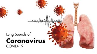 Sounds of Coronavirus COVID19  Lung Sounds [upl. by Nate]