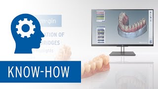 Ceramill MGin – New features of the software module for the digital fabrication of implant bridges [upl. by Bernj768]