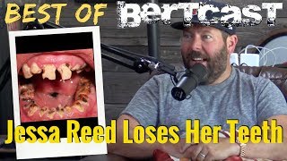 Jessa Reed Loses Her Teeth  Bertcast Clip [upl. by Ellyn30]