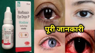 Moxifloxacin eye drops Moxibow eye drops price side effects uses Aankh ka best drops [upl. by Hedveh]