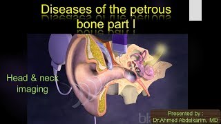 5pathology of the petrous bone I [upl. by Cyndie]