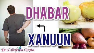 Dhabar Xanuunka Oo Xal Waara Loo Helay [upl. by Reace194]