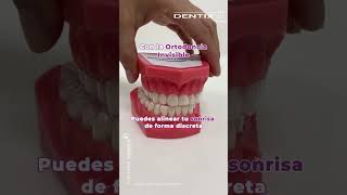 🎃 ¡25 en ortodoncia invisibleAprovecha hasta el 31 de octubre OrtodonciaInvisible Dentix [upl. by Ssilem]