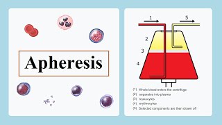 apheresis [upl. by Eillas]